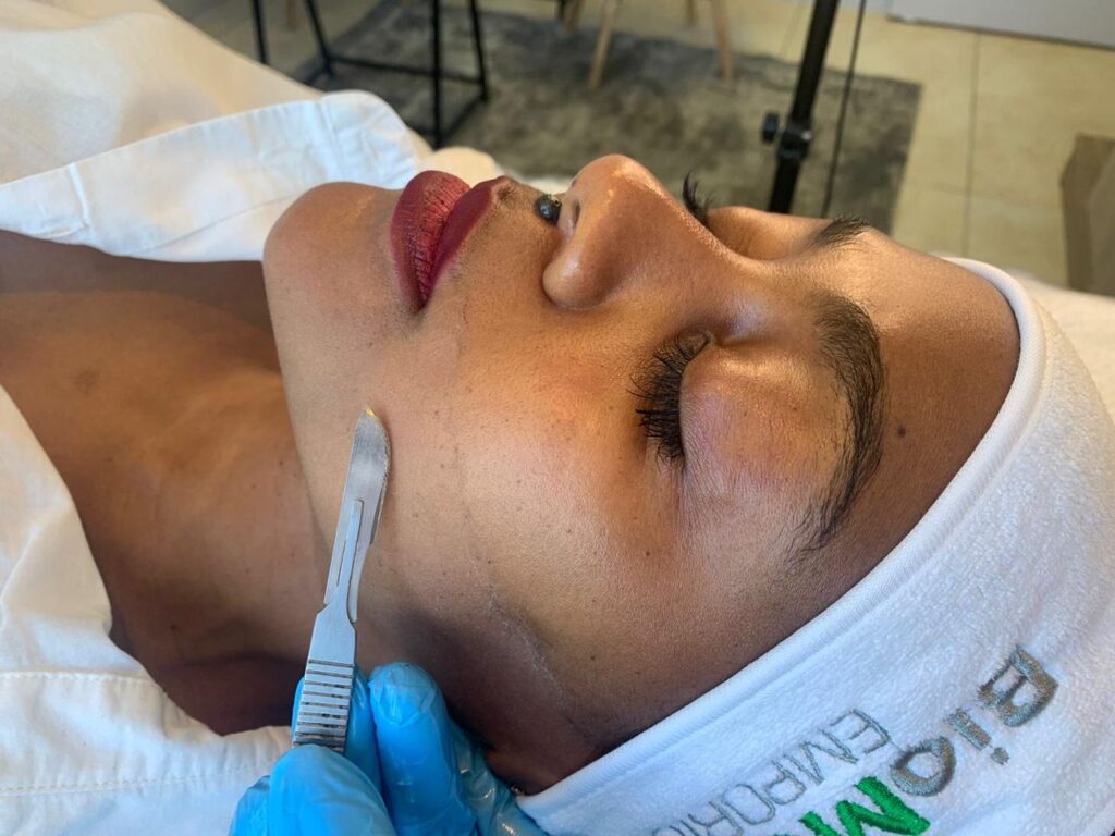 dermaplaning treatment in progress